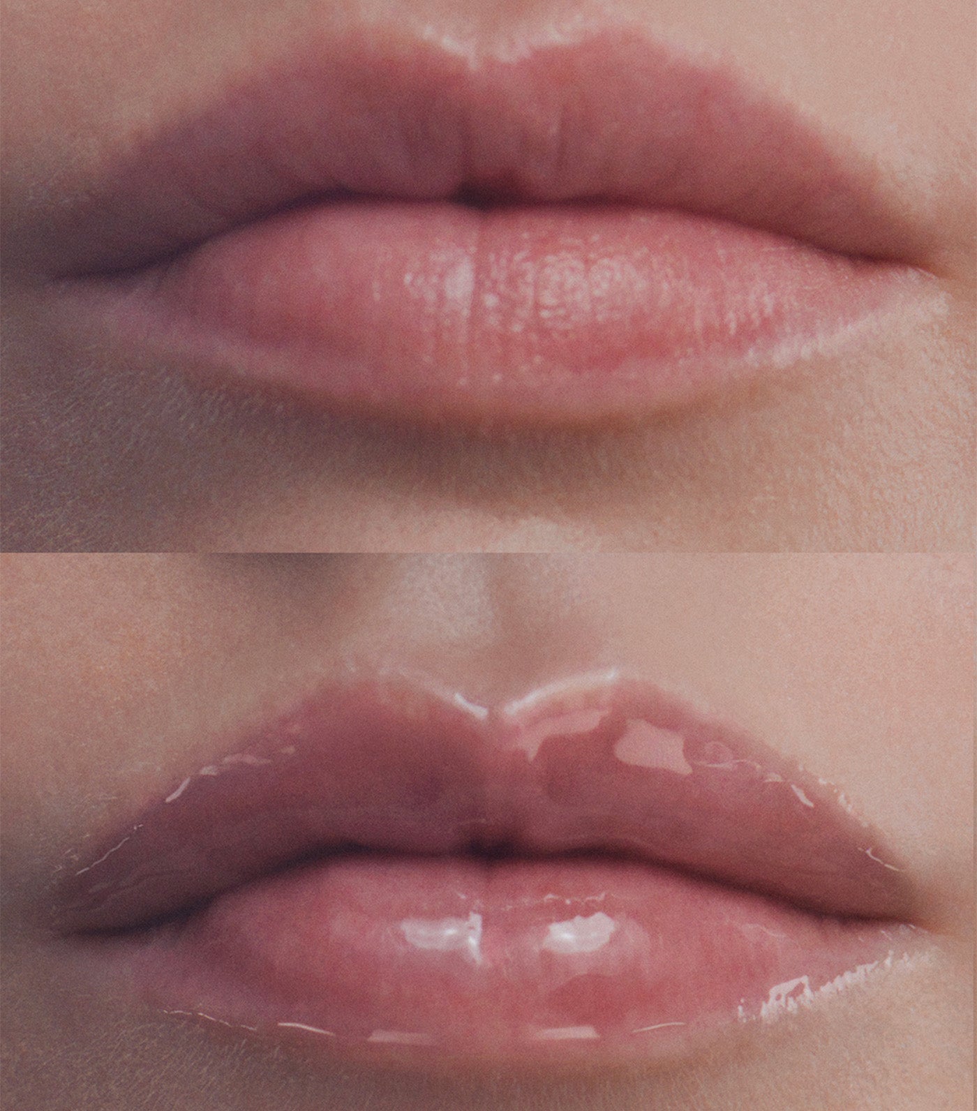 Hyalu-Filler Lips Volumizing Lip Balm