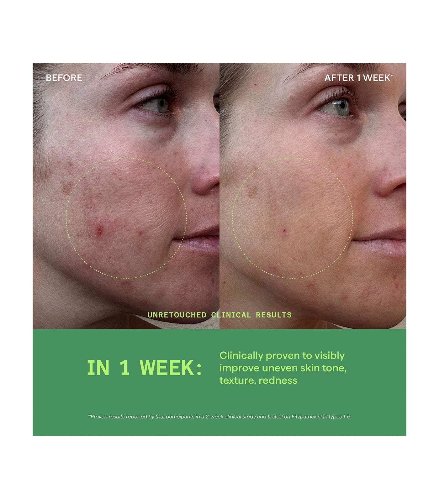 Biome-Balancing Calm & Recover Cream