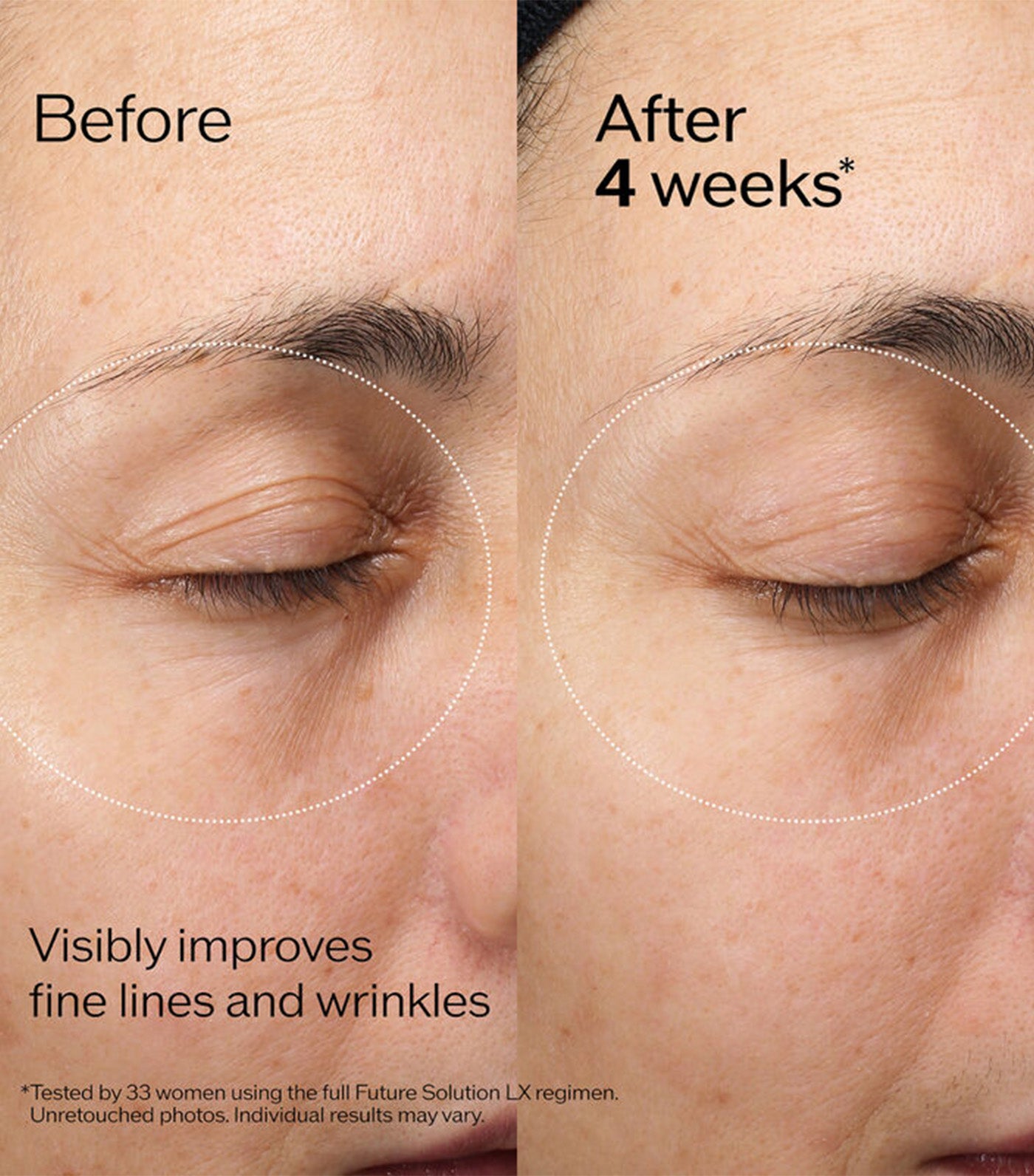 Eye and Lip Contour Regenerating Cream