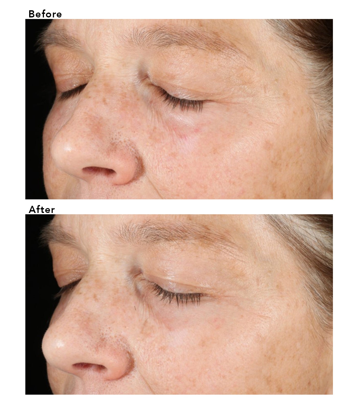 Murad Vita-C Triple Exfoliating Facial