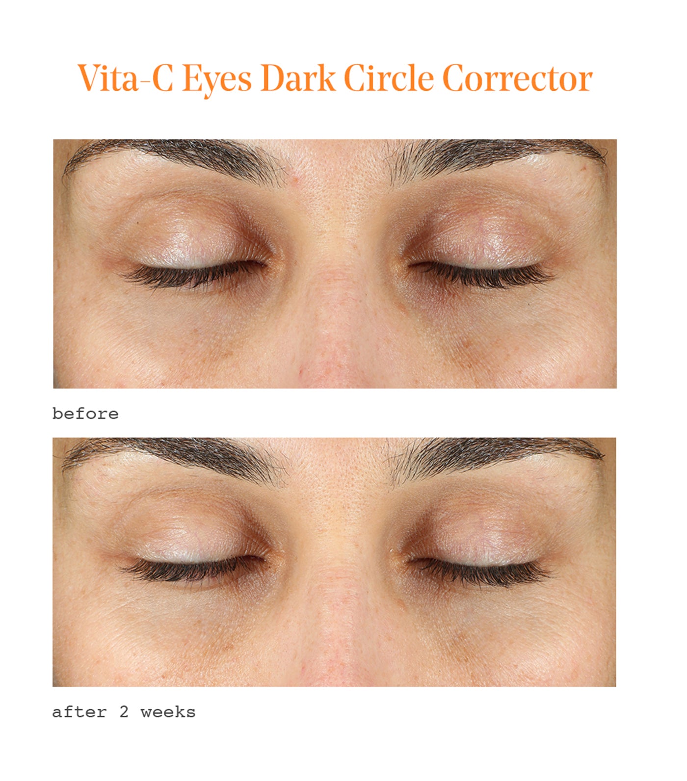Vita-C Eyes Dark Circle Corrector