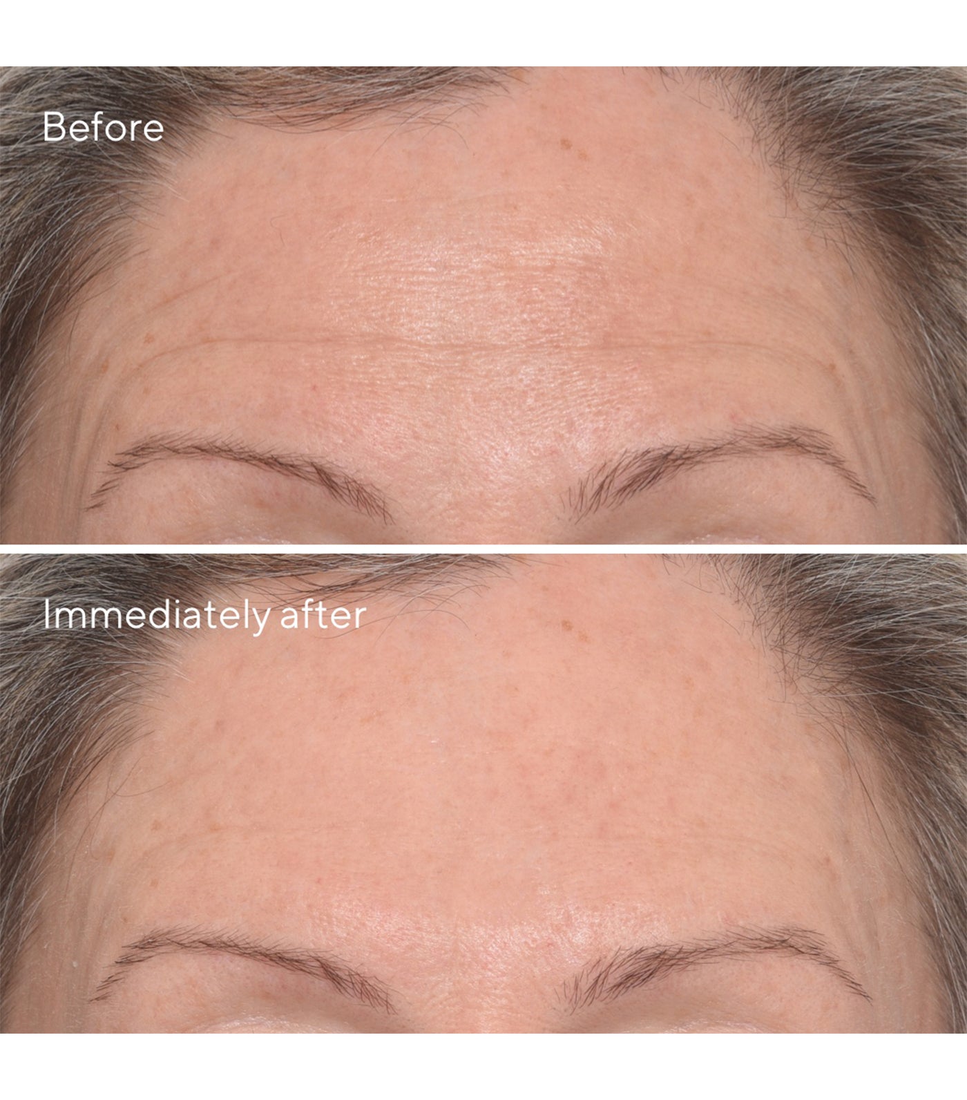 Targeted Wrinkle Corrector