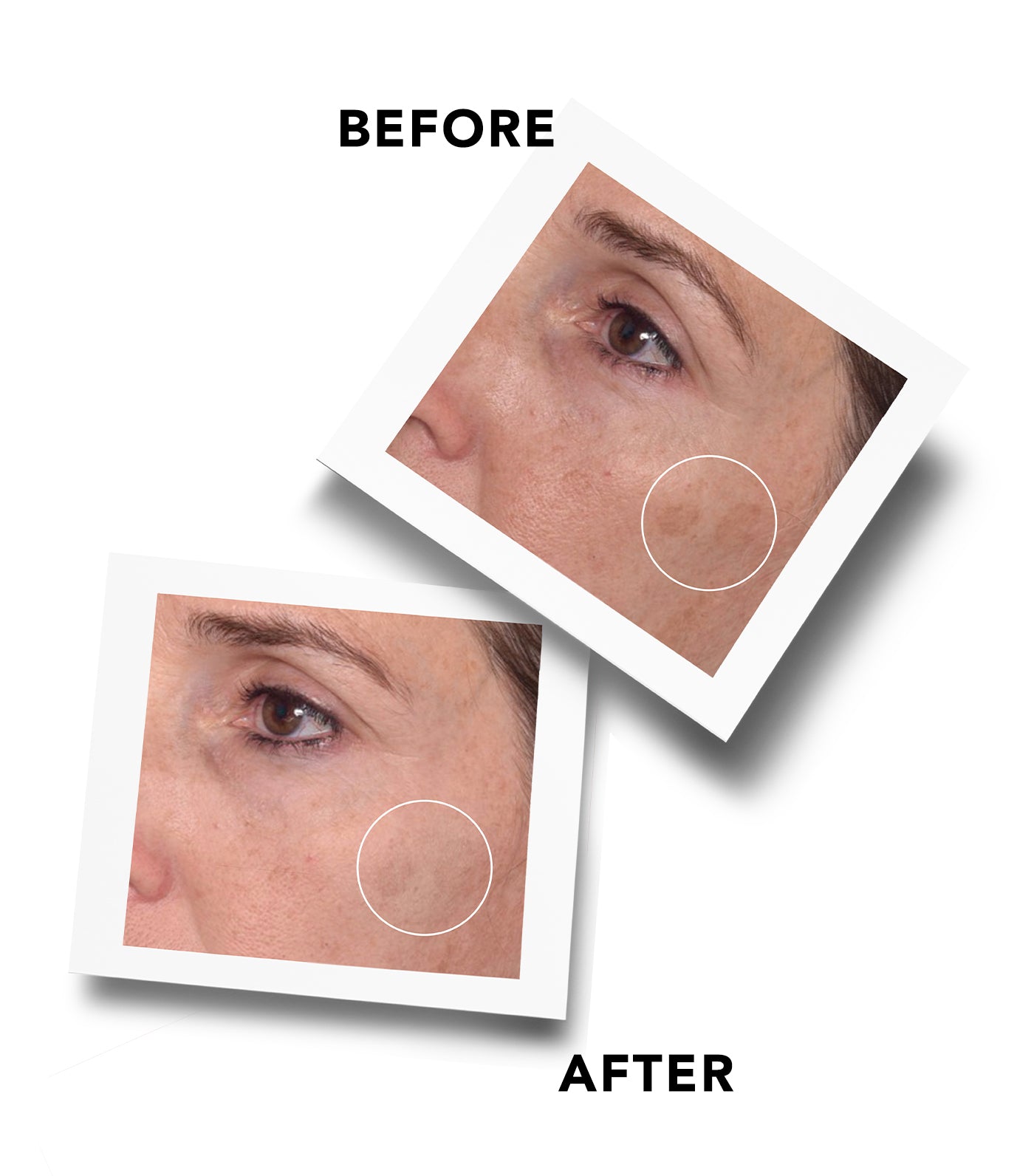 Rapid Dark Spot Correcting Serum