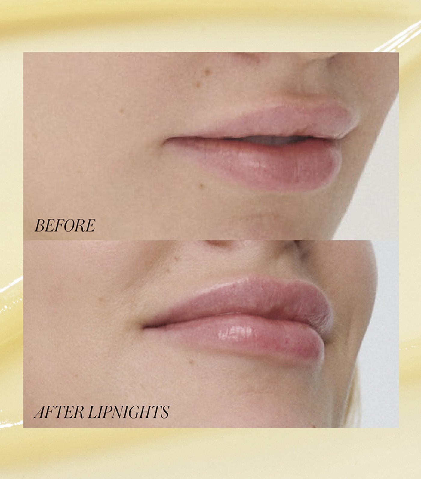 Lipnights Overnight Lip Mask