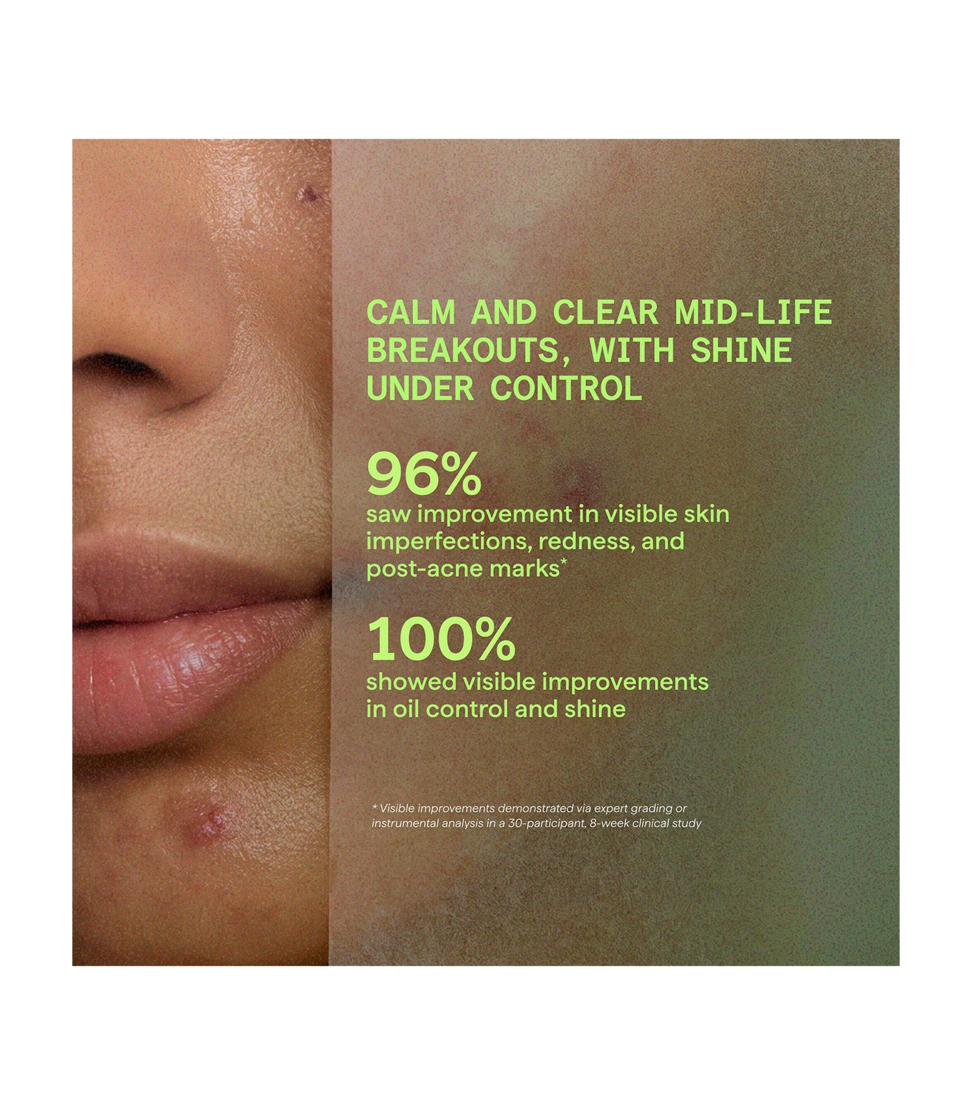 Biome-Balancing Calm & Recover Cream