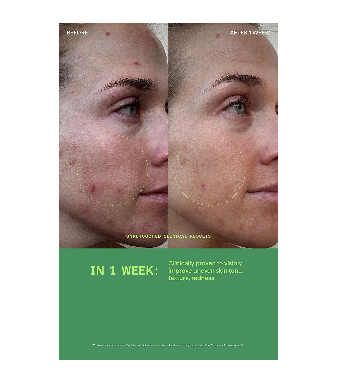 Biome-Balancing Calm & Recover Cream