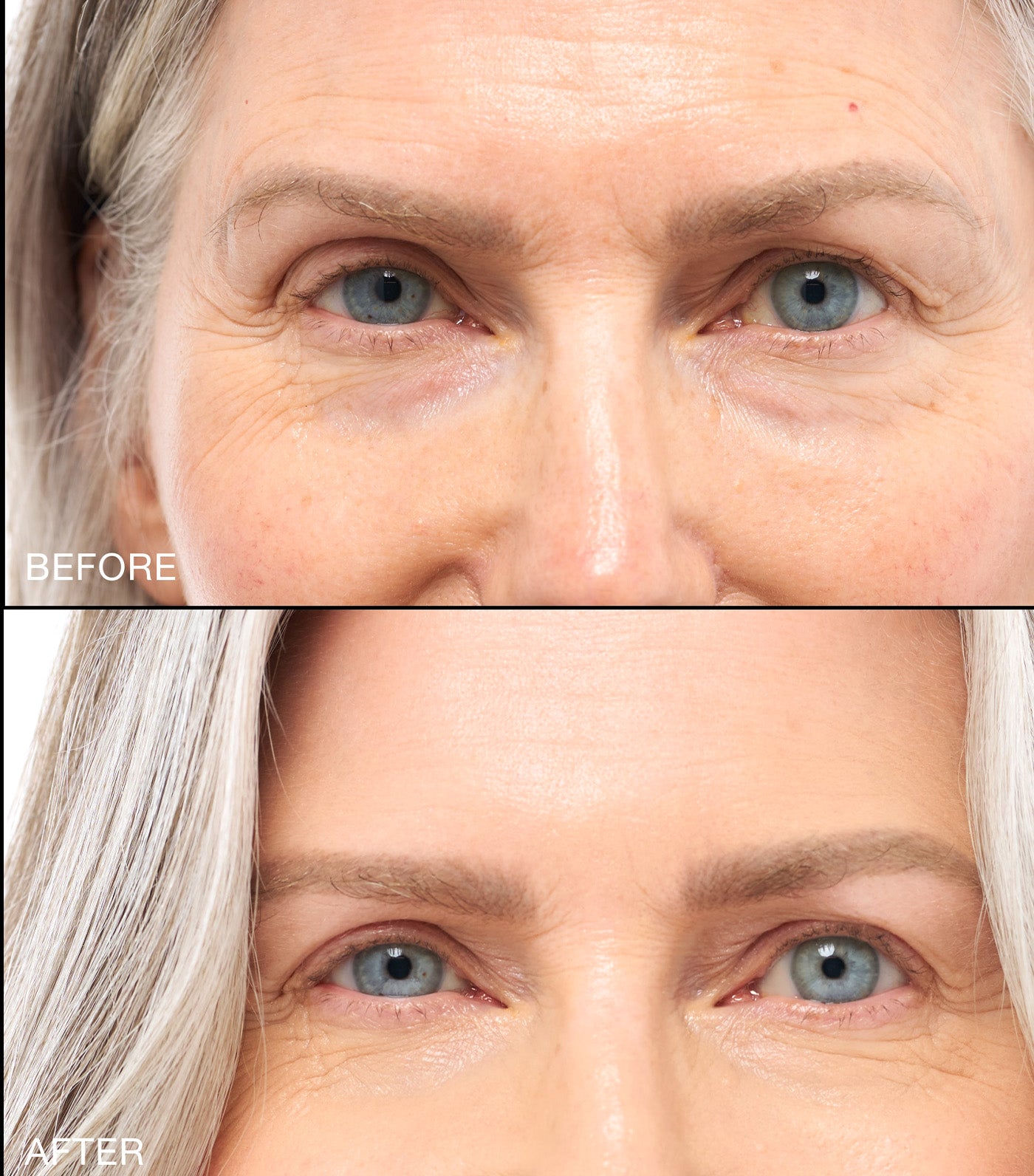 Revitalize Hydra Concealer